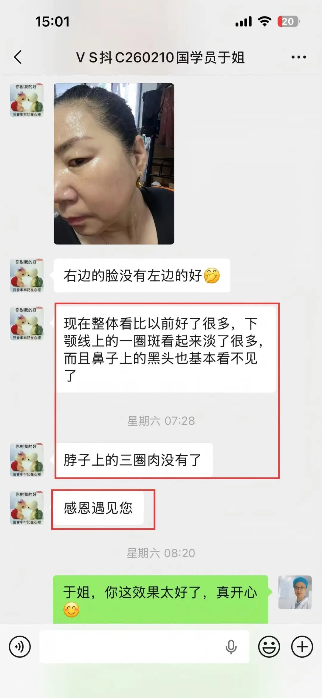 于姐：下颚线斑淡了，黑头没了，脖子上的三圈肉没了