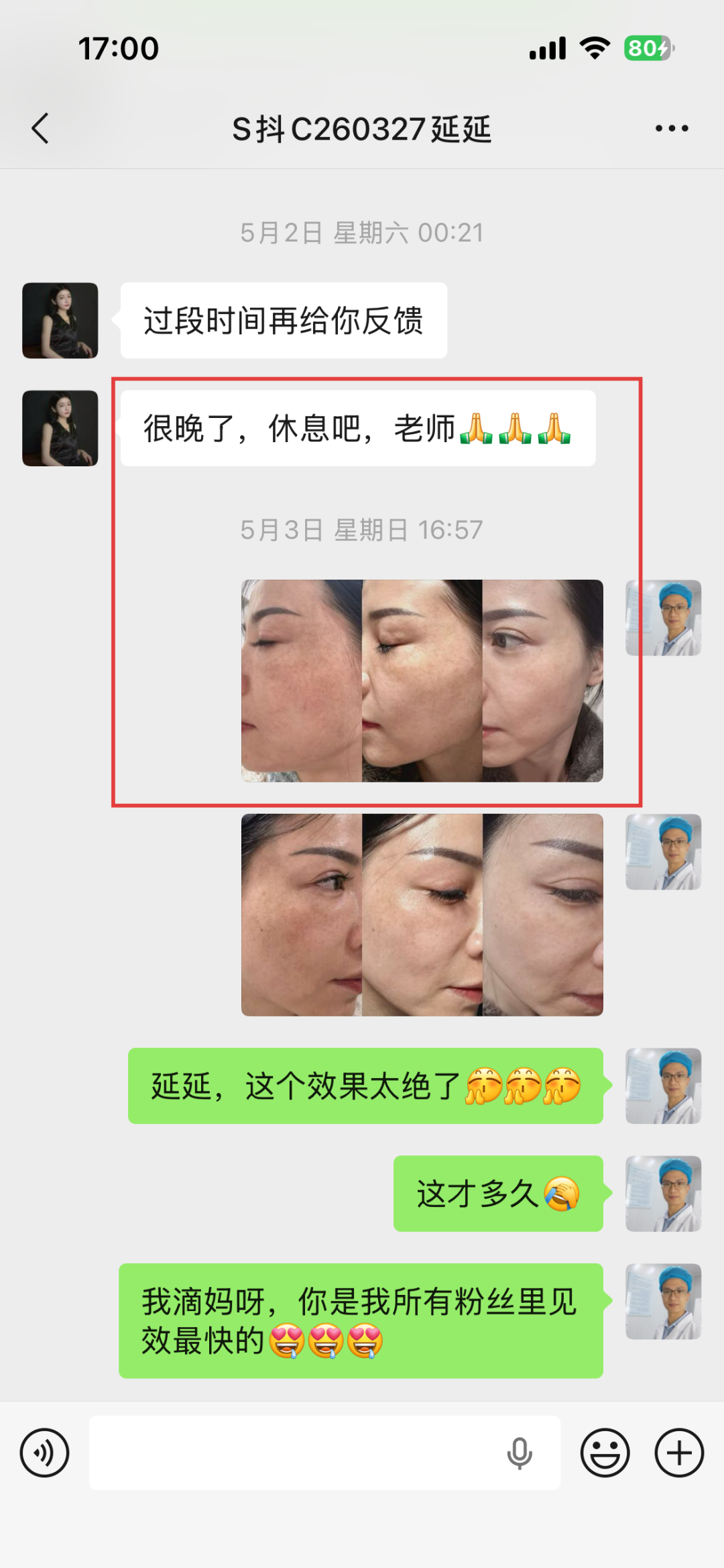 5月2日：延延的效果让我意外