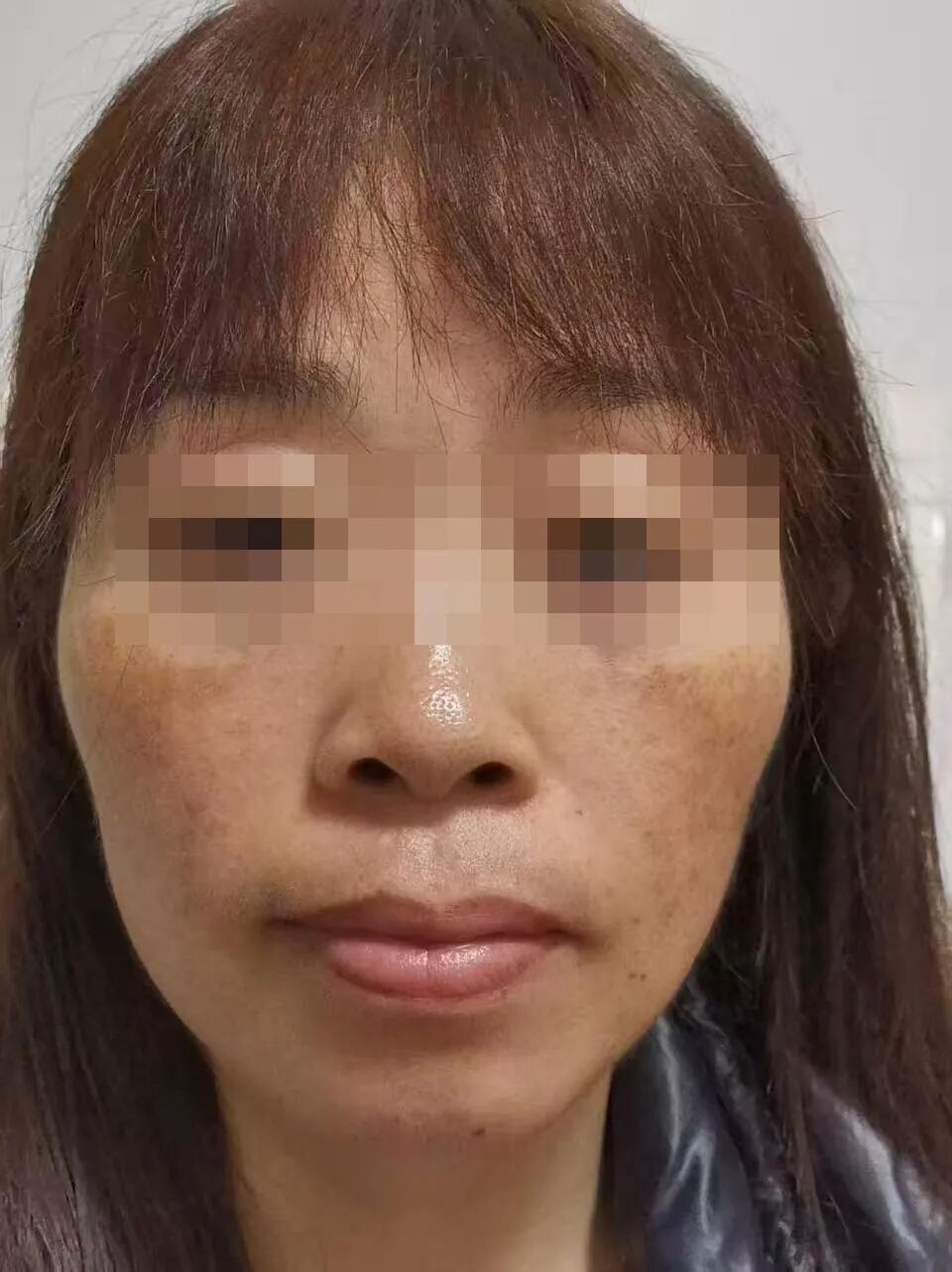 真·被做技术之前的正脸，色沉已经连成片