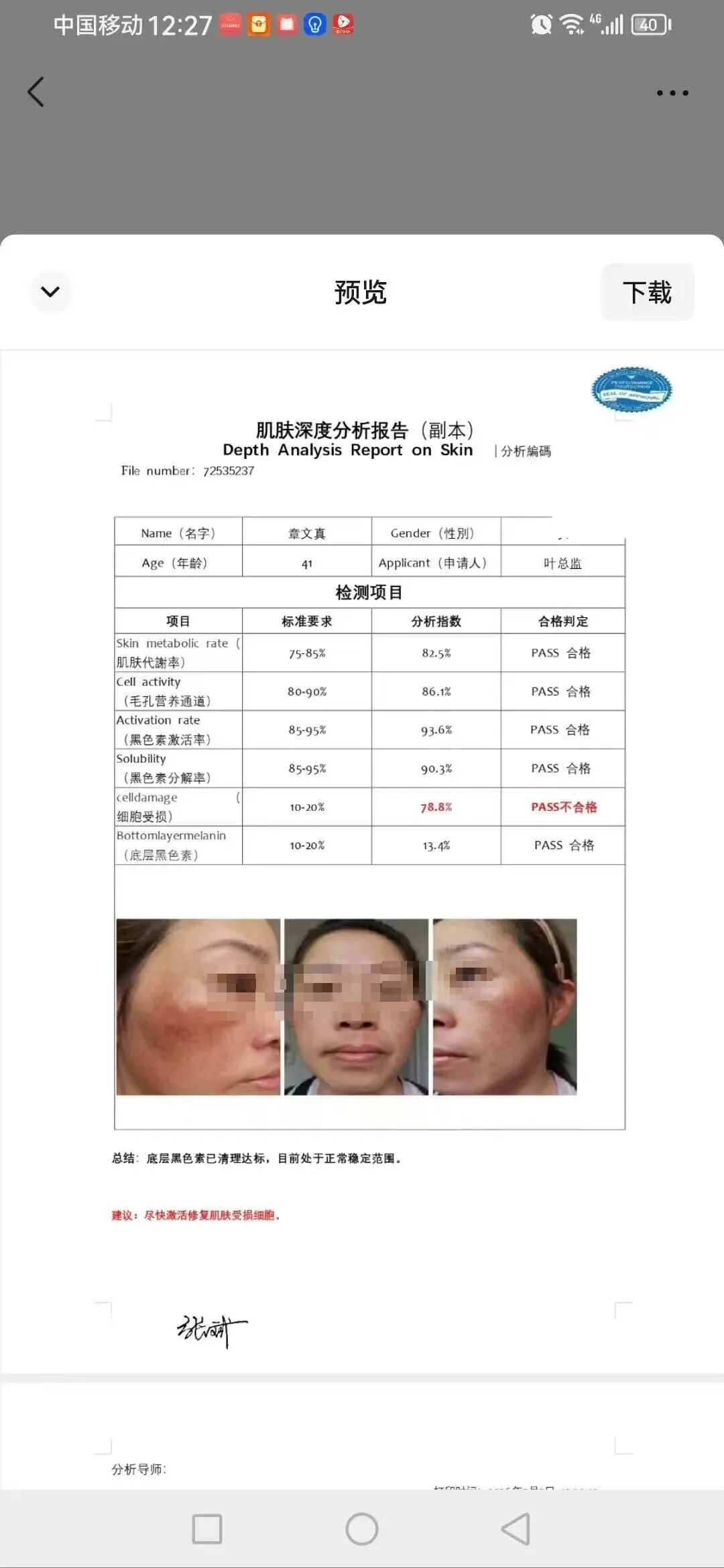 假报告三：同一份报告里底层黑色素一会儿合格一会儿不合格