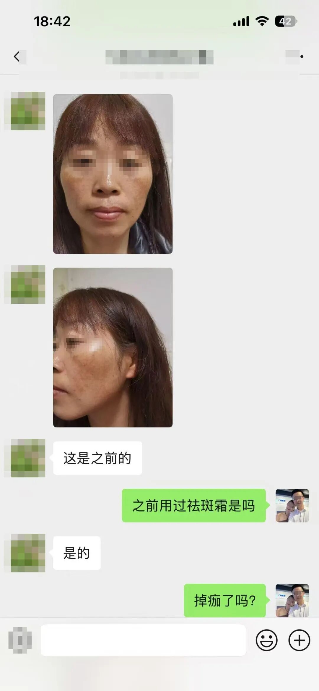 5月22日23:25 科文确认面积更大了、颜色更深了