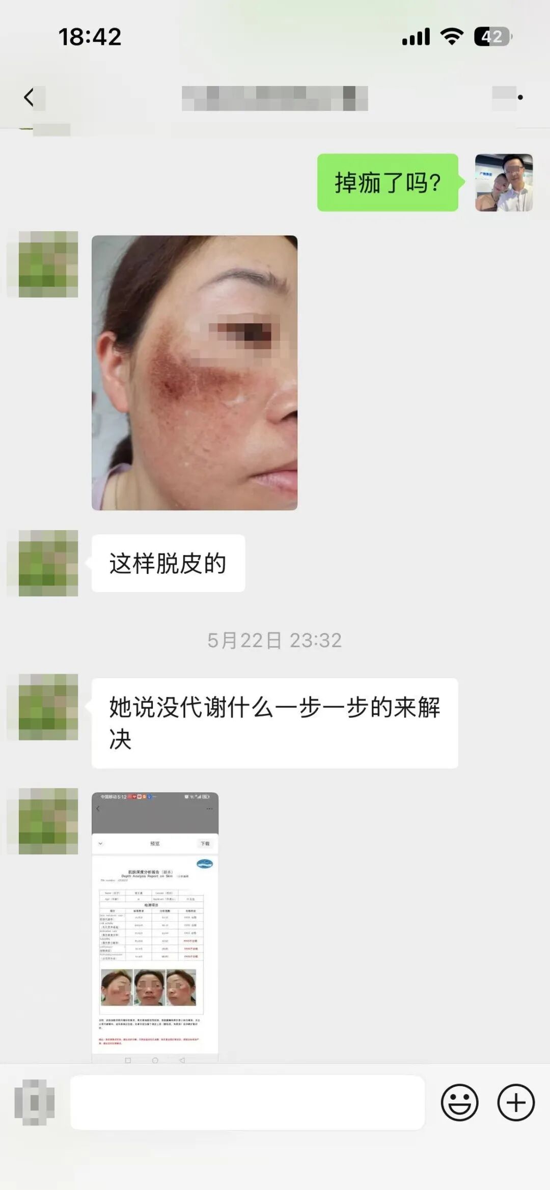5月22日 确认用过淡斑霜、掉过痂