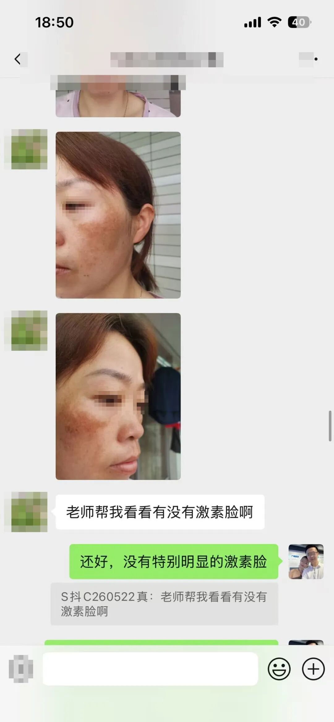 5月28日 先确认有没有皮肤依赖状态